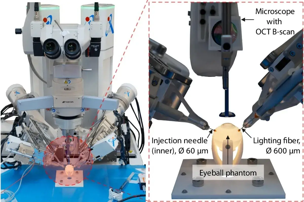 En este momento estás viendo Investigadores chinos desarrollan robot para cirugía ocular