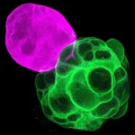 Cerebro humano en miniatura revela el mecanismo de autoconexión cerebral