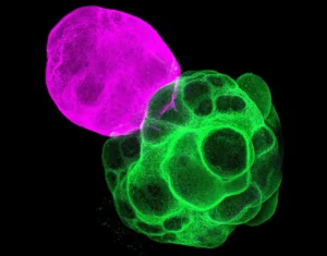 Lee más sobre el artículo Cerebro humano en miniatura revela el mecanismo de autoconexión cerebral