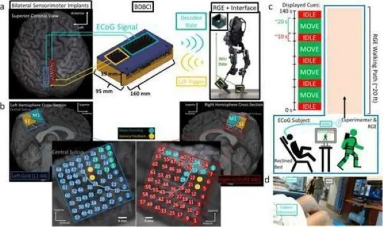 Interfaz cerebro-computadora bidireccional restaura sincrónicamente la marcha y la sensibilidad en pacientes paralizados