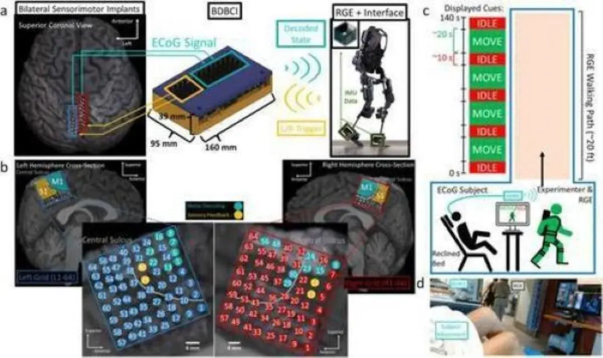 En este momento estás viendo Interfaz cerebro-computadora bidireccional restaura sincrónicamente la marcha y la sensibilidad en pacientes paralizados